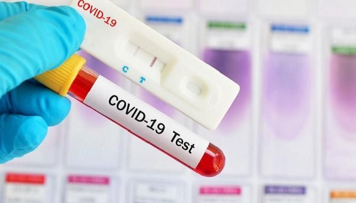 Ahli Epidemiologi Nilai Pemerintah Sumbar Salah Paham Maknai Testing Covid-19