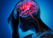 Selain Lumpuh, Ternyata Tanda Ini Juga Bisa Indikasi Gejala Stroke