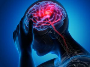 Selain Lumpuh, Ternyata Tanda Ini Juga Bisa Indikasi Gejala Stroke