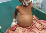 Ternyata Skema Program Kesehatan Gratis Pemkab Pessel Belum Jelas