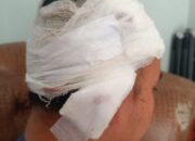 Tagih Hutang, Pemuda Ibuah Dikeroyok di Ompang Tanah Sirah, Kepala Robek 28 Jahitan